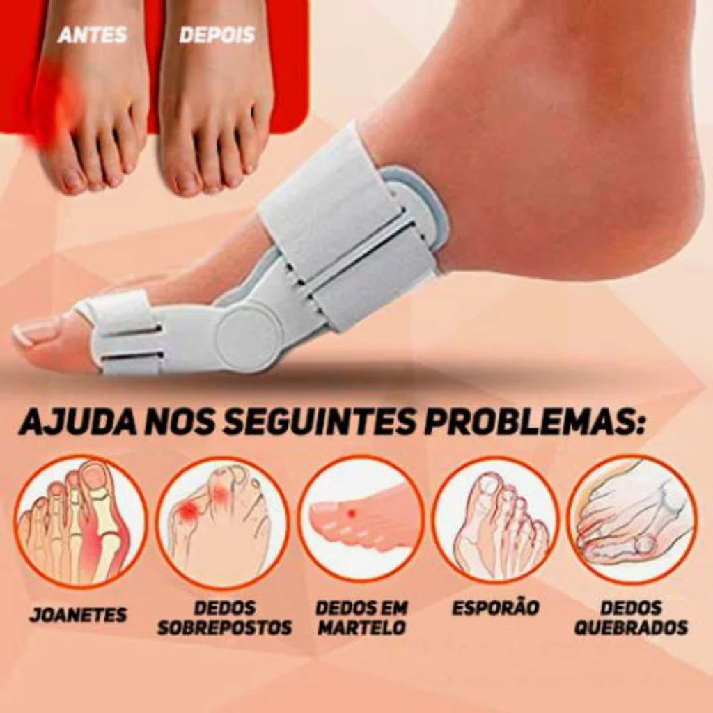Aparelho Corretor Articulado para Joanete - đŸđđđđđ đ, đđđđ đź