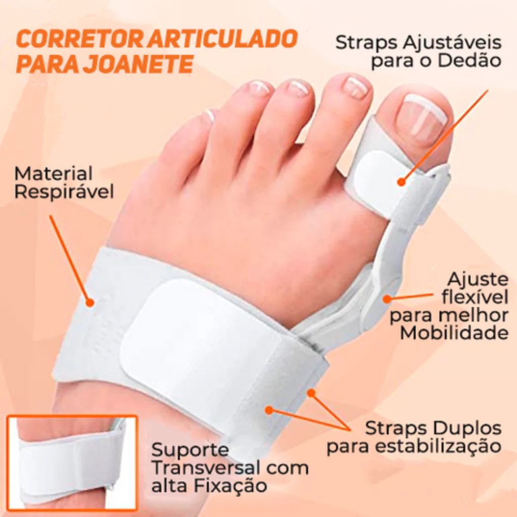 Aparelho Corretor Articulado para Joanete - 𝘾𝙊𝙈𝙋𝙍𝙀 𝟭, 𝙇𝙀𝙑𝙀 𝟮